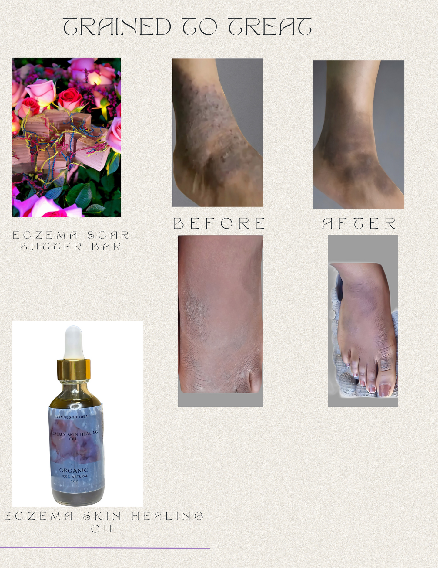 Eczema Skin Healing Oil